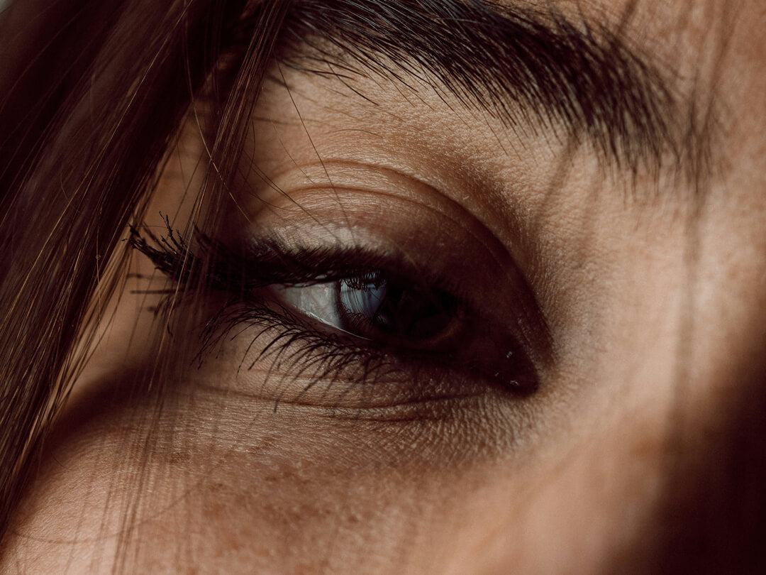 Trockenheitsfältchen Augen