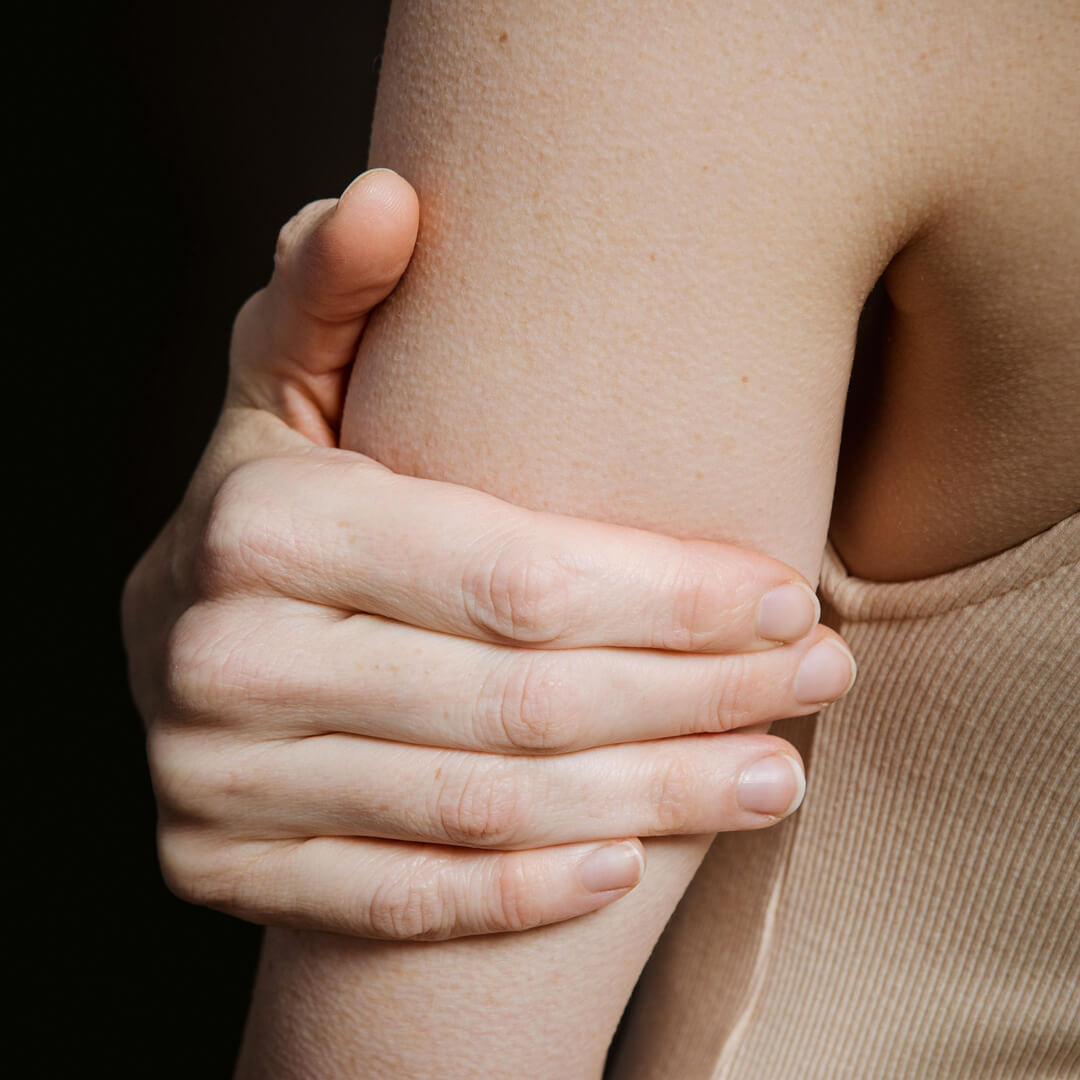Reibeisenhaut – Hand an Arm Symbolbild